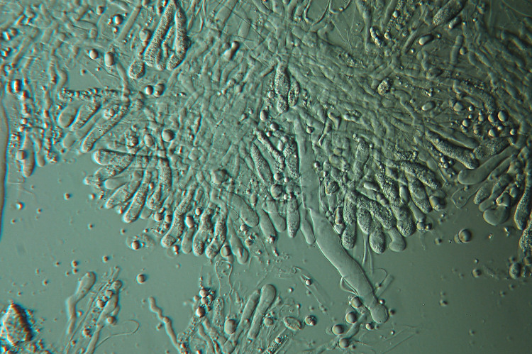 Plasmodio vs Phanerochaete?-foto3517(Hyphoderma roseocremeum